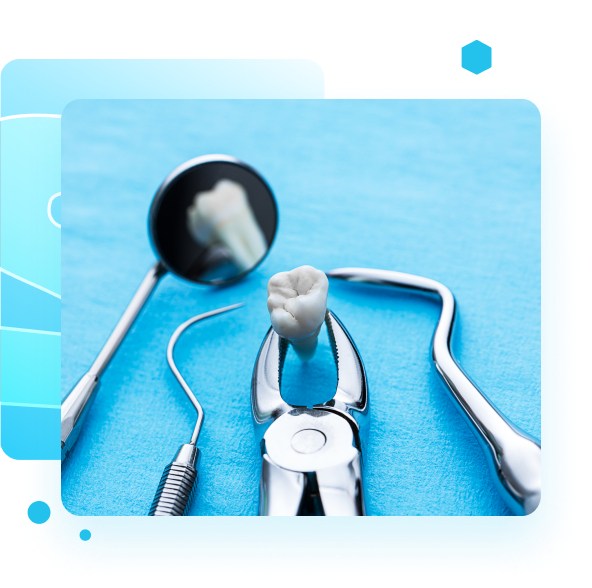 Tooth Extraction