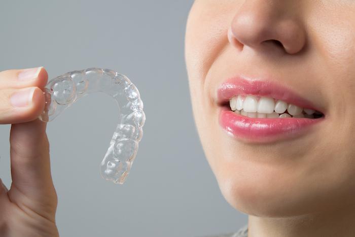 Significant Benefits of Invisalign