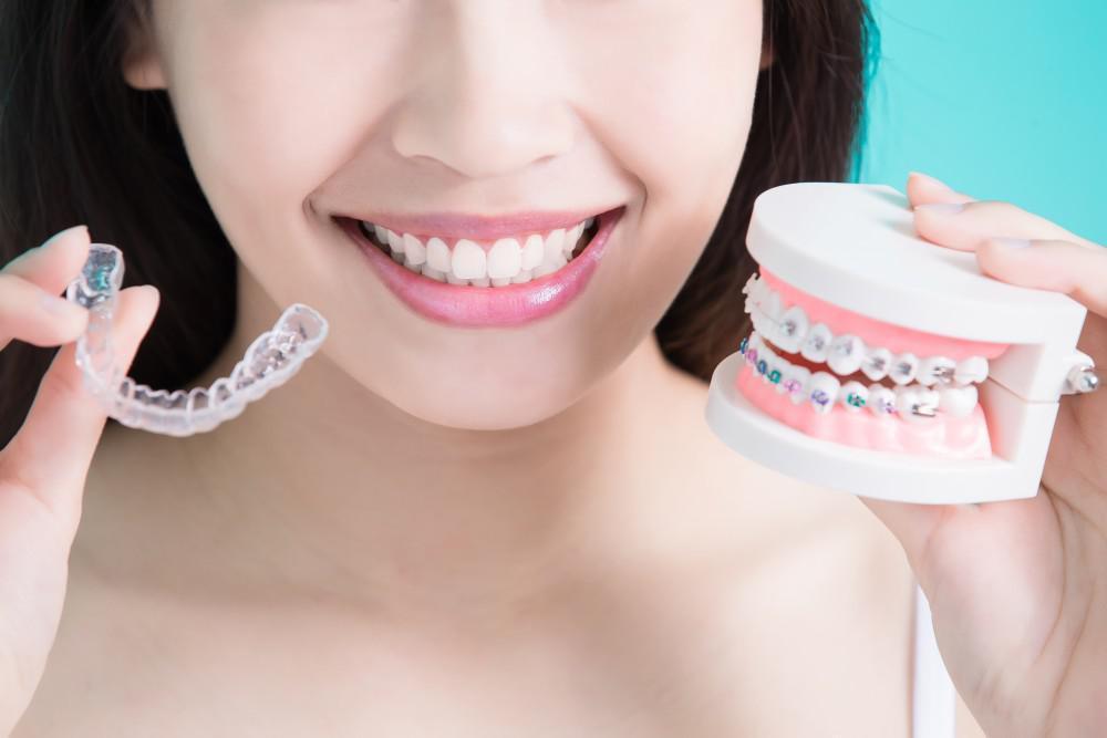 Braces Vs. Clear Aligners