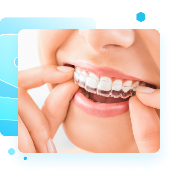 Trident Smiles Dental  Average Invisalign cost: How expensive is